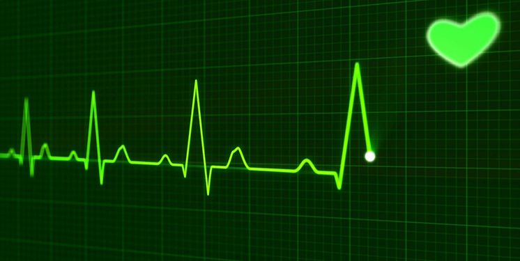 Electrocardiografía (ECG) y frecuencia cardíaca (HR) - Tecnologías